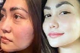 Lucent Glutathione Dubai & Abu Dhabi .